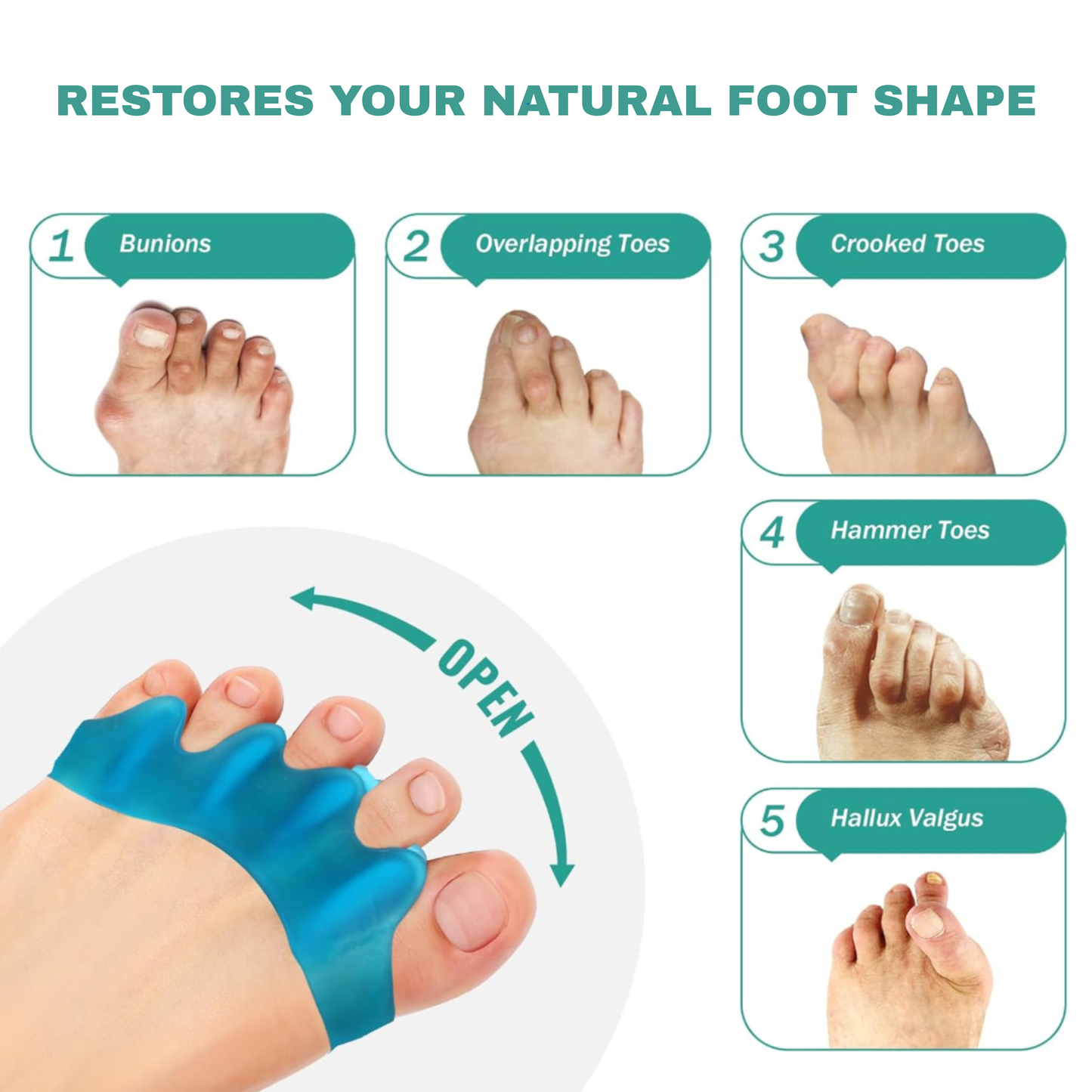 ReAlign Toe Separators
